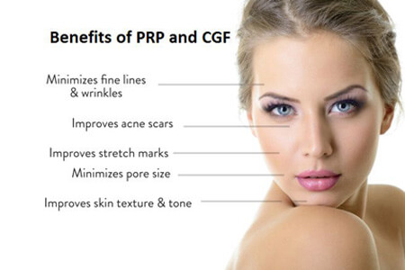 PRP/CGF Skin Rejuvenation