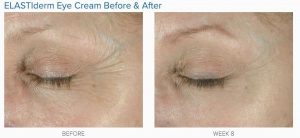 Obagi Elastderm Eye Treatment