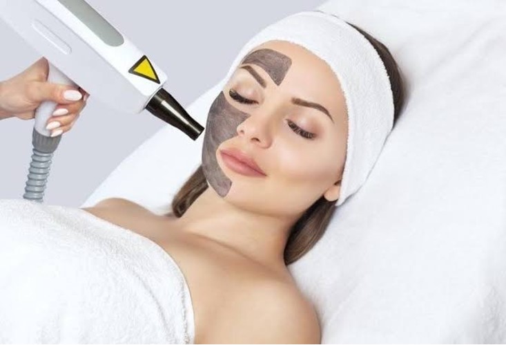 Carbon Facial